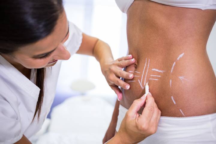 Lipo HD amplia possibilidades da definição corporal