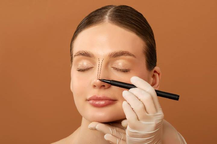 Rinoplastia alia estética e função respiratória