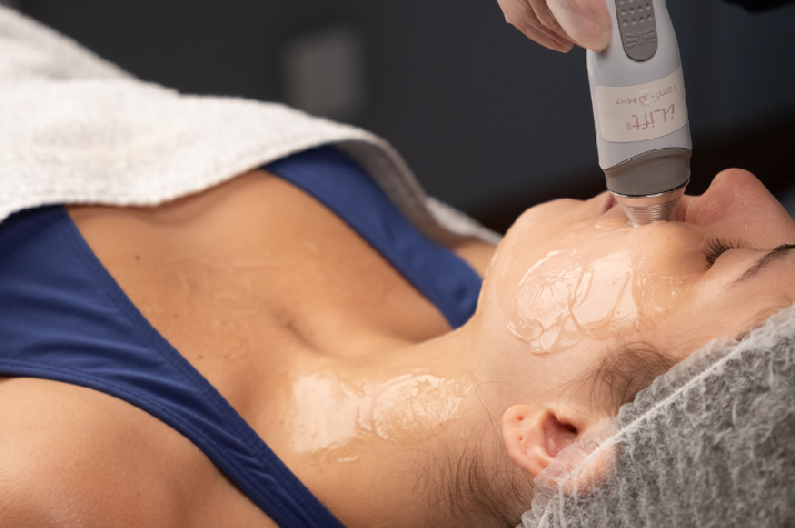 Ultrassom terapêutico avança no rejuvenescimento facial