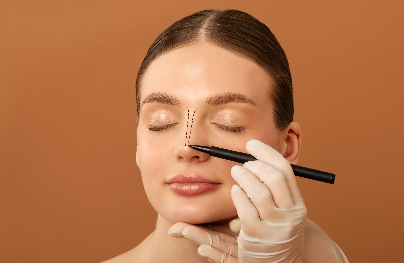 Rinoplastia alia estética e função respiratória
